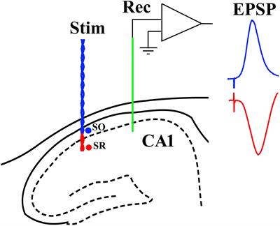 Pre-plaque Aß-Mediated Impairment of Synaptic Depotentiation in a Transgenic Rat Model of Alzheimer’s Disease Amyloidosis